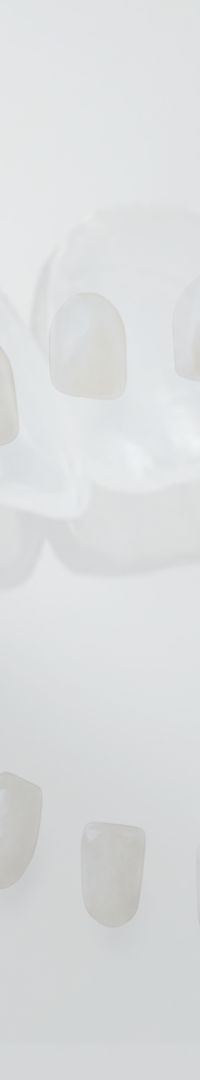 Things to Keep in Mind When Searching for a Laminate Dentistry Clinic Near Sinsa Station image 20