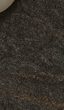 Systematic Examination Process to Review Before Deciding on Front Teeth Laminates image 43