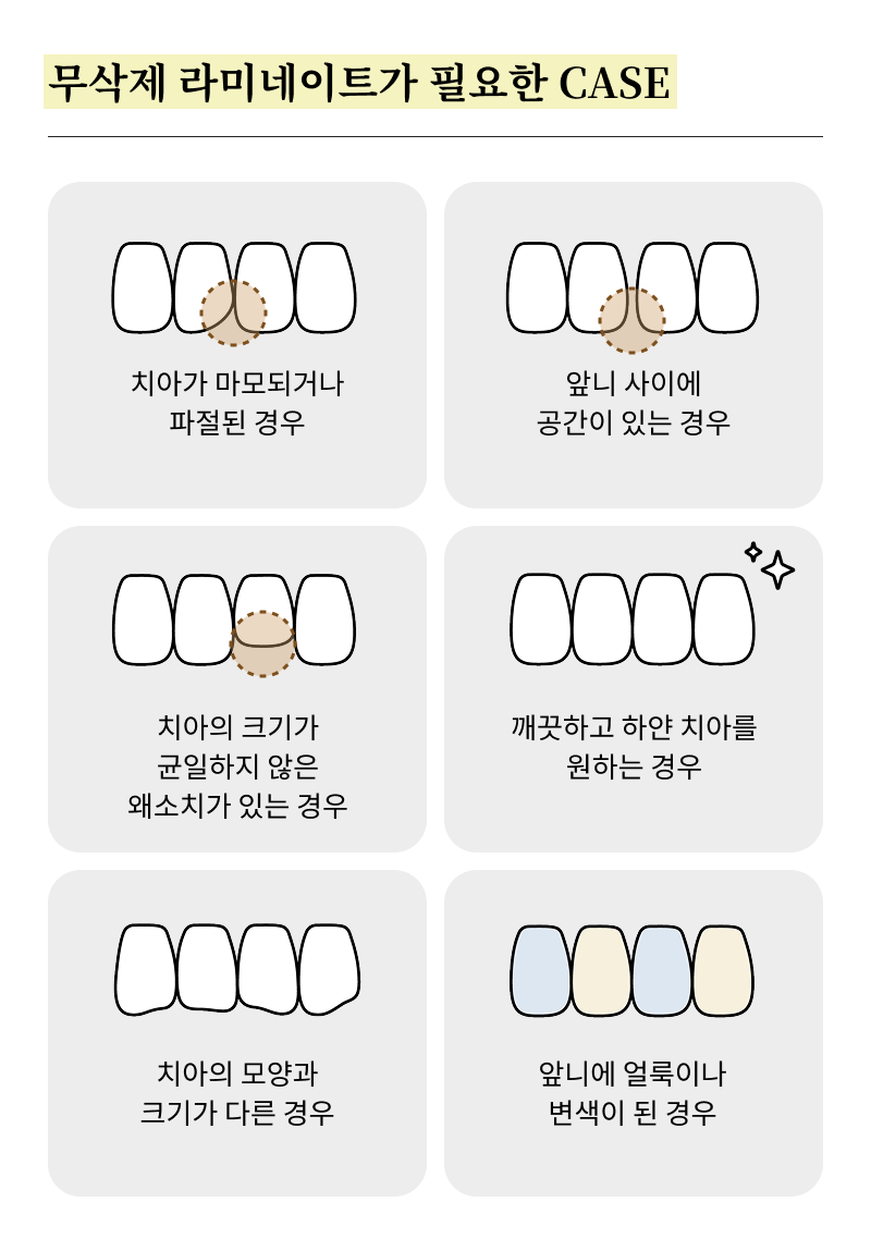 Systematic Examination Process to Review Before Deciding on Front Teeth Laminates image 17