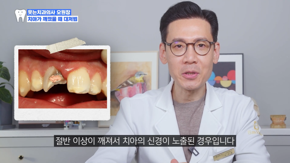 앞니깨짐 토요일치과에서 티 안나게 당일 수복 가능할까? 관련 이미지 5