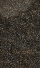 Systematic Examination Process to Review Before Deciding on Front Teeth Laminates image 46