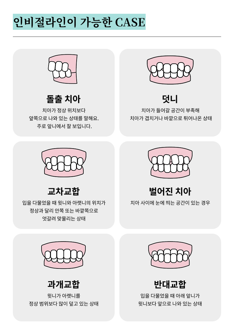 A Summary of How to Use Clear Aligners and Step-by-Step Guidelines image 14