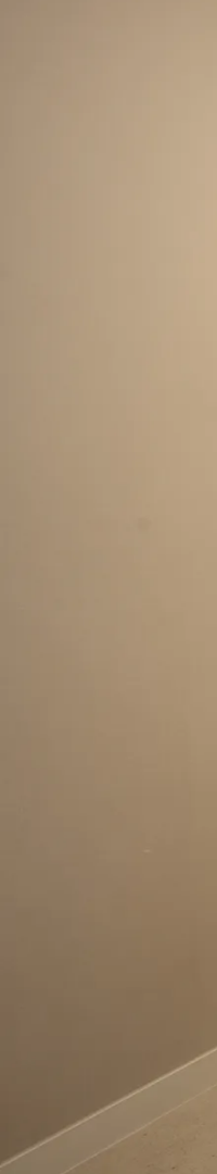 네비게이션 임플란트 식립과정 정확한 계획이 중요한 이유 관련 이미지 31