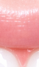 What to Check Before Choosing a Gangnam Laminate Dental Clinic image 31