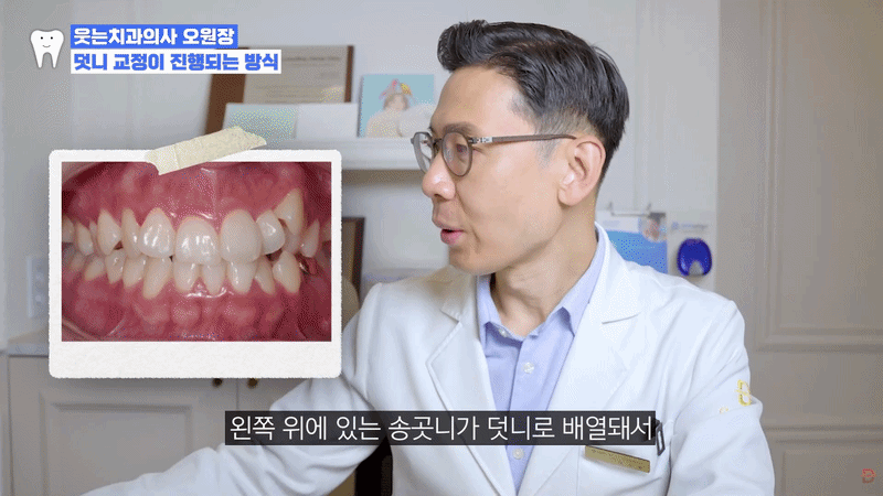 Orthodontic Treatment for Crooked Teeth: Insights from a Dental Clinic near Gangnam Sinsa Station image 6