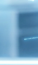 돌출입 교정 기간 줄일 수 있을까? 기간 단축을 돕는 핵심 요소 관련 이미지 37