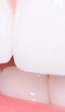 What to Check Before Choosing a Gangnam Laminate Dental Clinic image 39