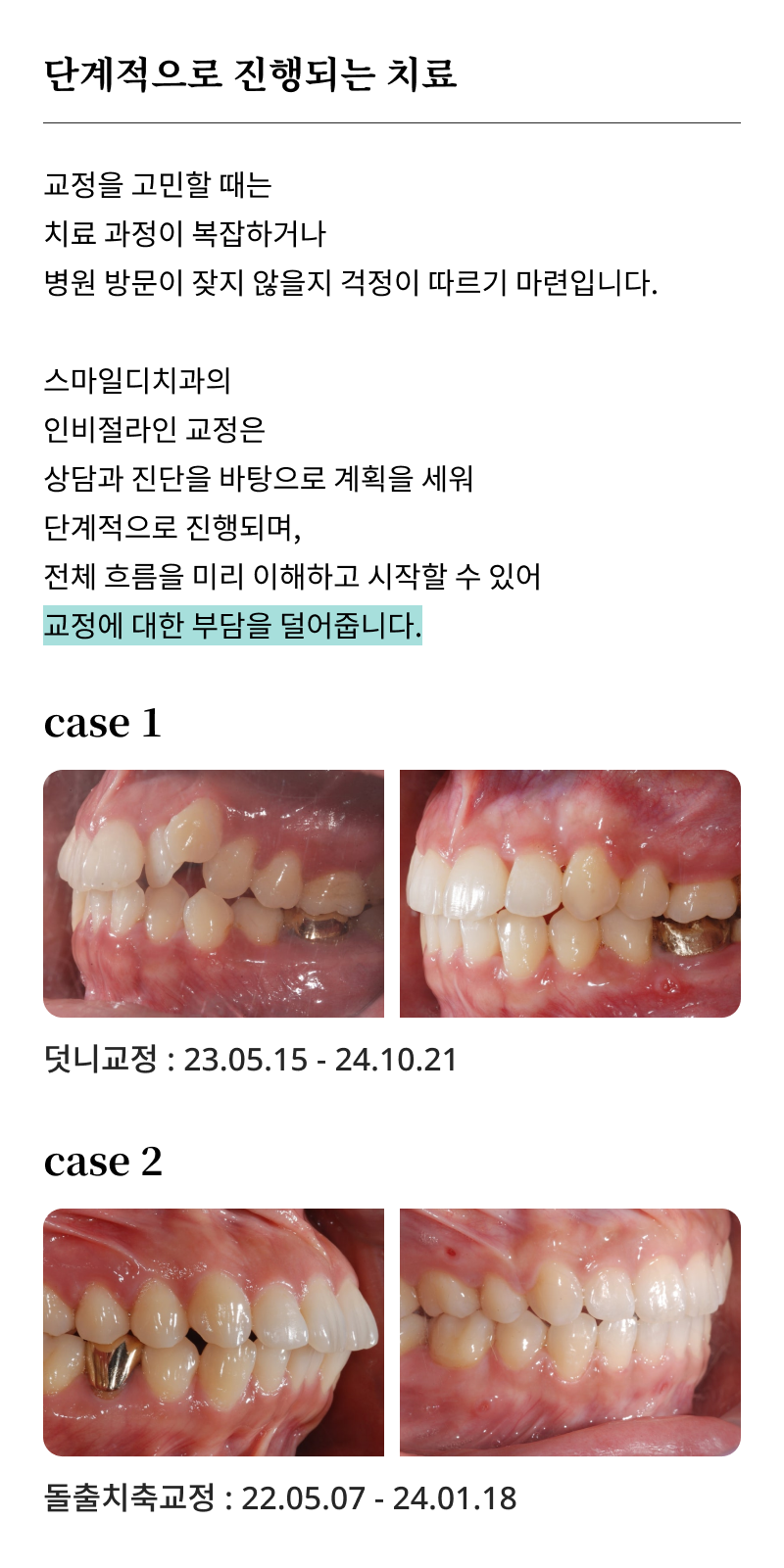 A Summary of How to Use Clear Aligners and Step-by-Step Guidelines image 18