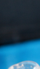 성인 돌출입 교정, 발치 없이도 변화가 가능할까? 관련 이미지 33