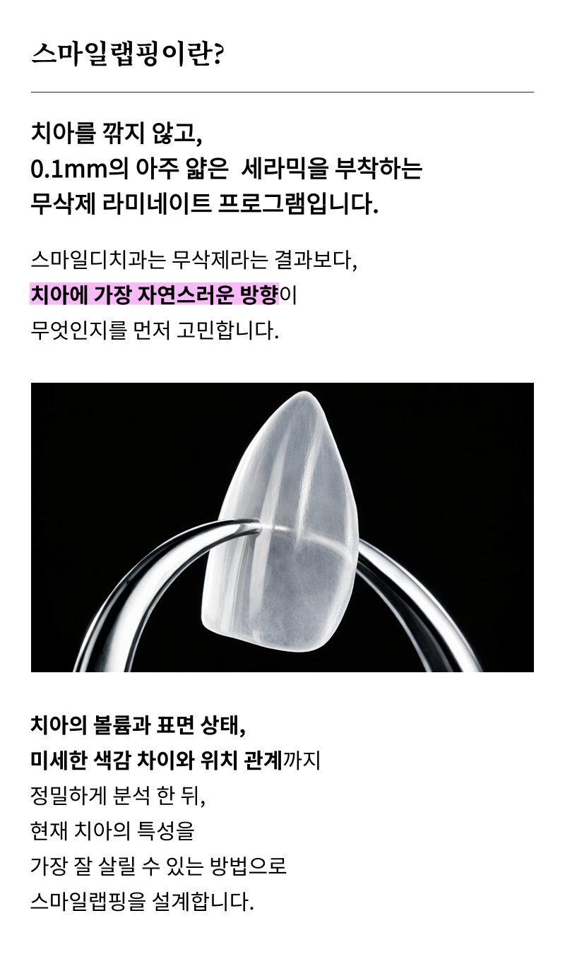 압구정라미네이트치과 장기적 안정성을 위한 필수 지침 관련 이미지 10