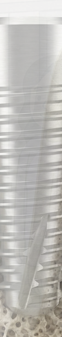 Invisalign Retainer Duration: A Detailed Look image 33