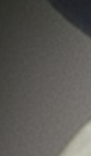 강남무삭제라미네이트치과 선택을 위한 정밀 정보 관련 이미지 27