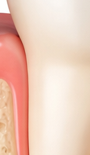 If You’re Considering a Seoul Implant Dental Clinic image 40