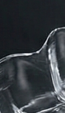 신사역치과 치아교정 전 꼭 확인해야 할 정밀 진단 기준 관련 이미지 35