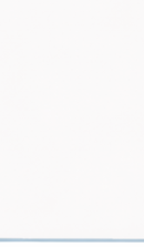 압구정 라미네이트치과 자연스러운 완성을 위한 선택 기준? 관련 이미지 31