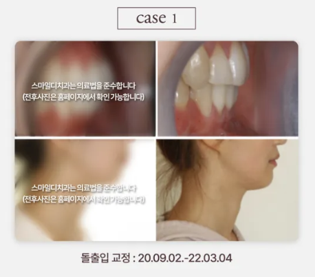 [안내] 스마일디치과의원입니다 관련 이미지 2