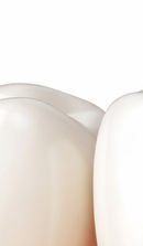 If You’re Considering a Seoul Implant Dental Clinic image 27