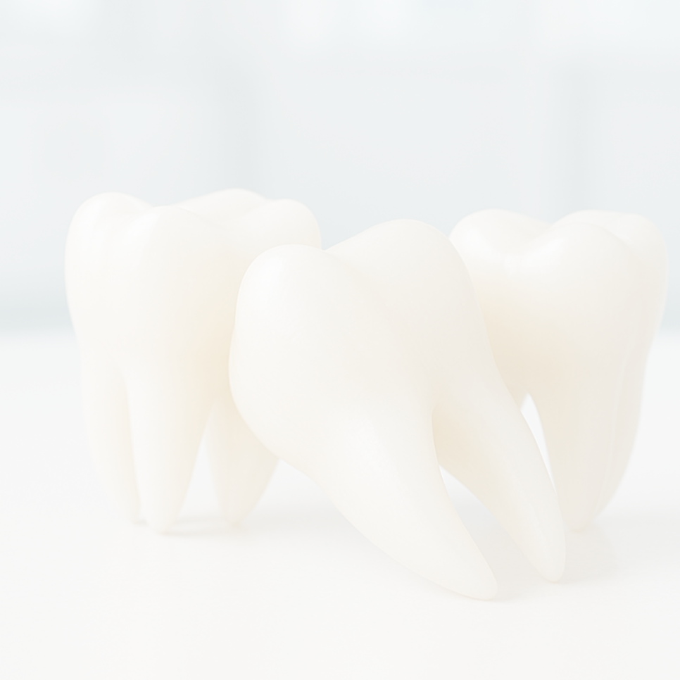 라미네이트 가격 병원 선택 전 꼭 알아야 할 점 관련 이미지 17