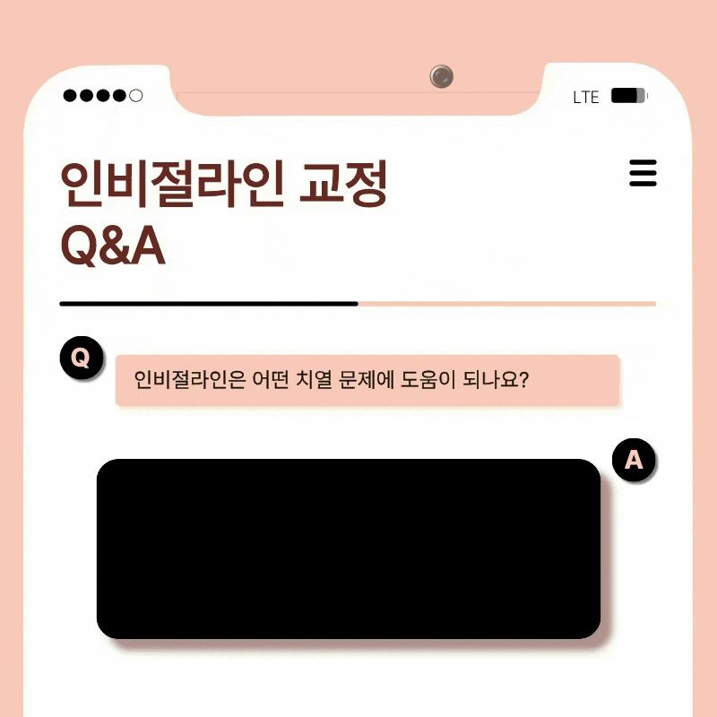 압구정치과 치아교정 고민하고 있다면 관련 이미지 12