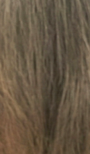 강남 전체임플란트 말하고 웃을 때의 자신감을 회복하려면 관련 이미지 30