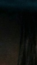 논현역교정치과 선택 전 반드시 확인해야 할 체크 포인트 관련 이미지 25