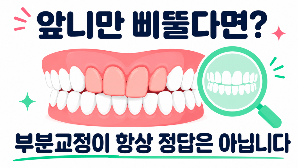 강남교정치과, 교정 종류보다 먼저 살펴야 할 선택 기준은? 관련 이미지 4