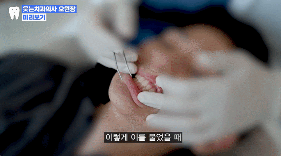 이갈이 이유, 단순한 습관이 아니라 부정교합 때문? 관련 이미지 2