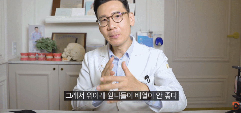 신사동치과 덧니부분교정 실패하기 싫다면 필독 관련 이미지 6