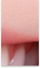 What to Check Before Choosing a Gangnam Laminate Dental Clinic image 35