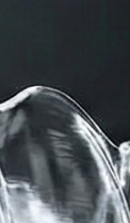 신사역치과 치아교정 전 꼭 확인해야 할 정밀 진단 기준 관련 이미지 32