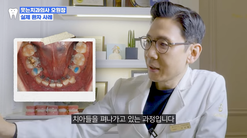 투명교정가격? 강남투명교정 가격대는 관련 이미지 4