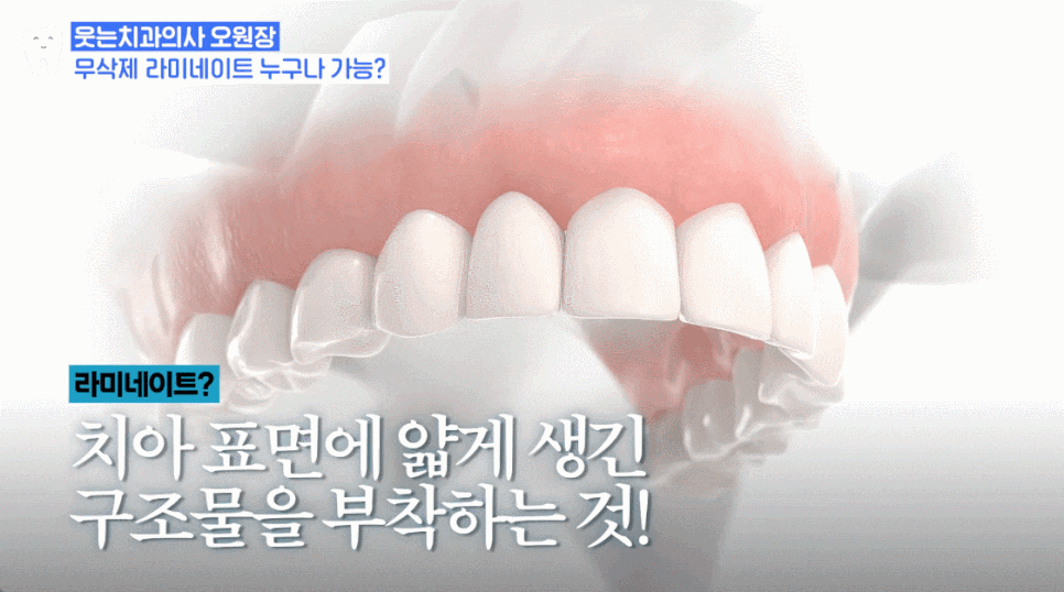 압구정라미네이트추천 시술 전 모르면 후회할 진실 관련 이미지 9