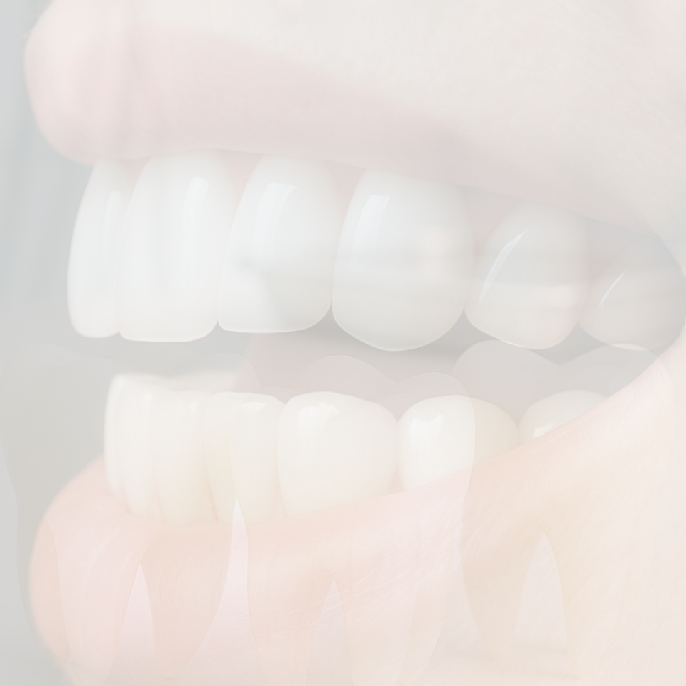 라미네이트 가격 병원 선택 전 꼭 알아야 할 점 관련 이미지 37