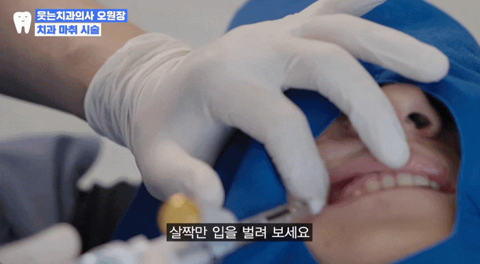 How Long Does Dental Anesthesia Take to Wear Off? Here’s a Clear Explanation to Ease Your Anxiety image 4