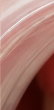 What to Check When Considering No-Prep Laminate Veneers in Gangnam image 27