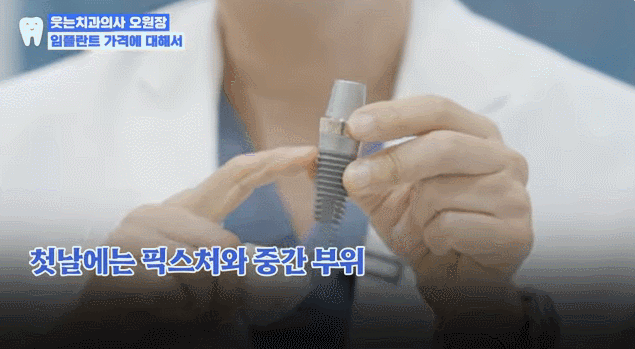 임플란트가격 00만원의 함정, 실제 총비용은 이렇습니다 관련 이미지 4