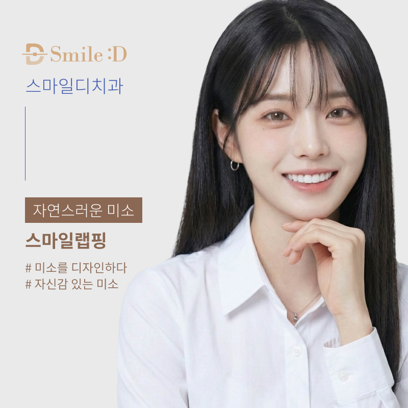 앞니 라미네이트 시술이 고민된다면 관련 이미지 23