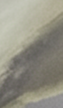 강남무삭제라미네이트치과 선택을 위한 정밀 정보 관련 이미지 37