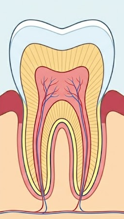 라미네이트 수명, 평생 사용할 수 있을까? 관련 이미지 2