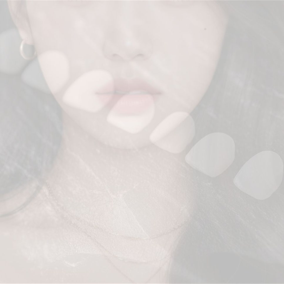 무삭제 라미네이트 후기 꼼꼼히 찾아봤어요 관련 이미지 20