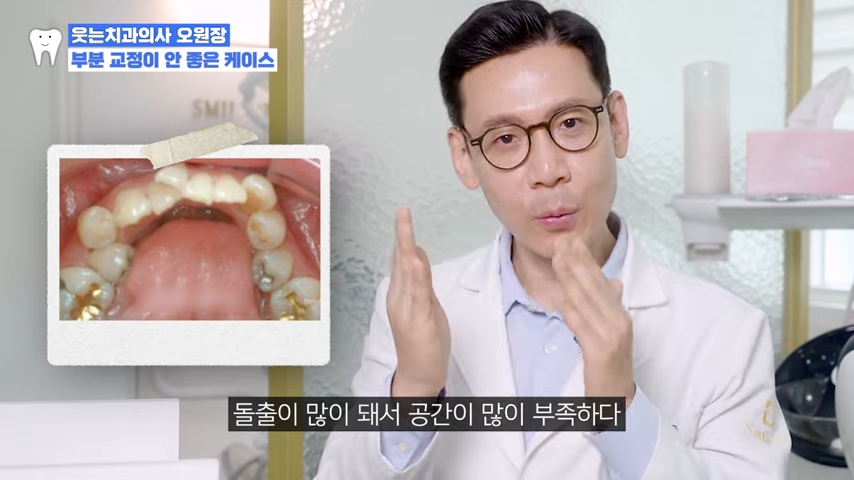 치아교정 앞니부분교정 가능할까? <전문의 답변> 관련 이미지 10