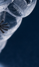 강남교정치과 결정 전 고려할 사항은 관련 이미지 41