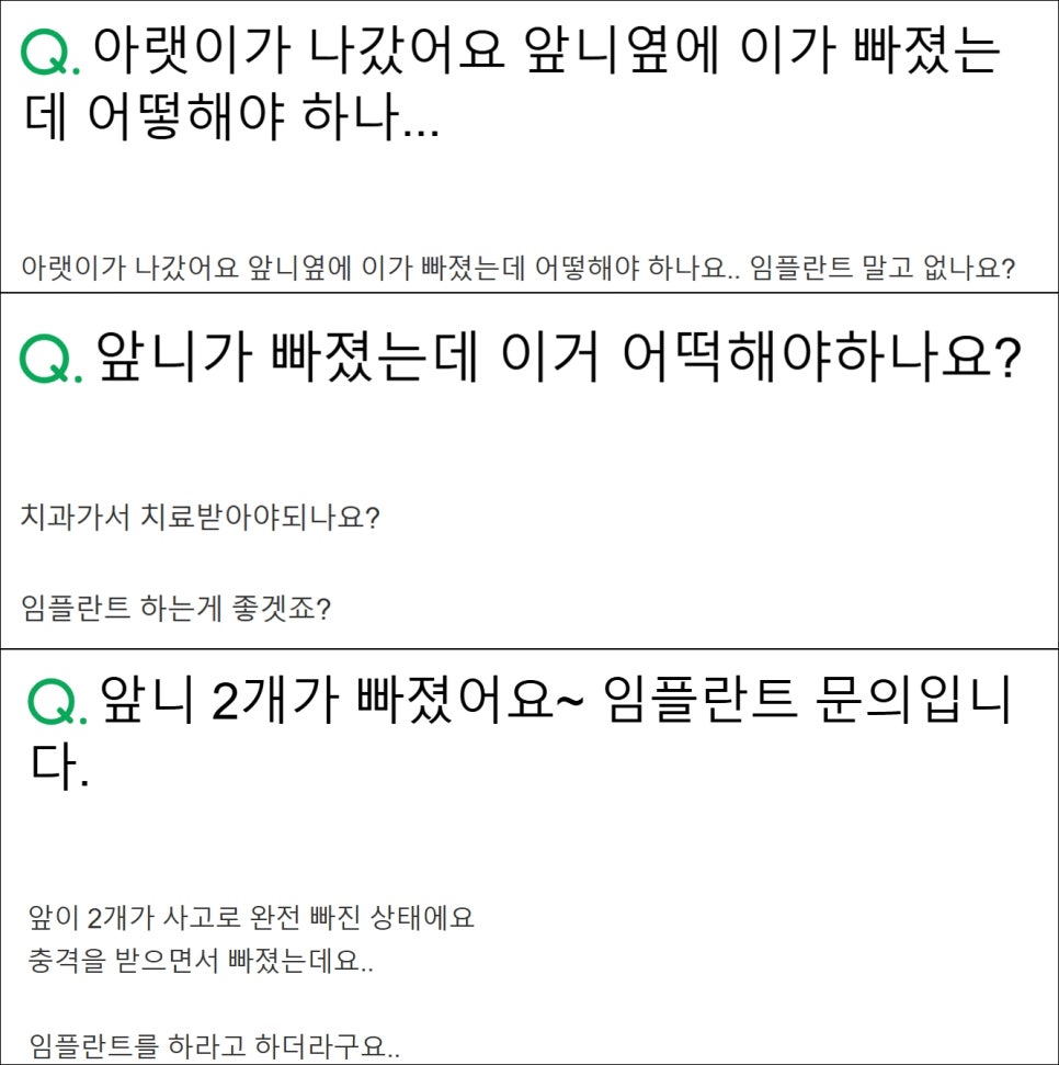 앞니임플란트치과 찾기 전 제발 이 글부터 읽어보세요 관련 이미지 7