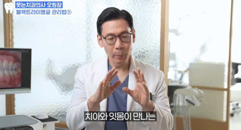 Black Triangle: 4 Ways to Fix the Gap Between Teeth <Revealed> image 15