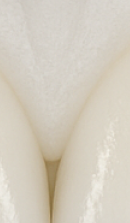 앞니 벌어짐 치료 전 반드시 체크해야 할 것들 정리 관련 이미지 30