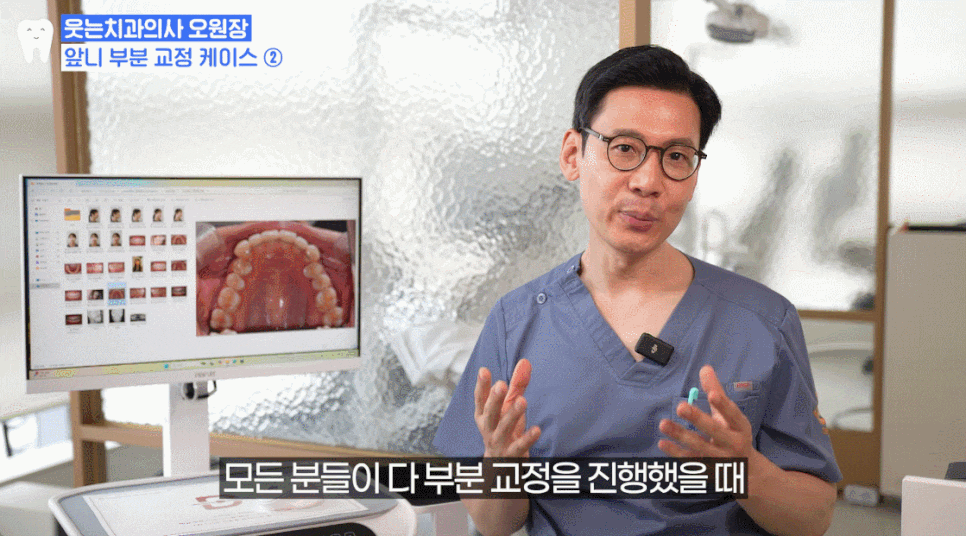 신사동치과 덧니부분교정 실패하기 싫다면 필독 관련 이미지 13