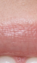 What should you be sure to check before deciding on Gangnam laminate dentistry? image 27