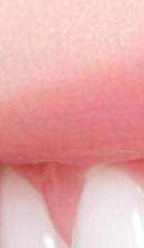 What to Check Before Choosing a Gangnam Laminate Dental Clinic image 28