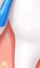 강남 교정치과 과정과 필수 분석 사항들 관련 이미지 39