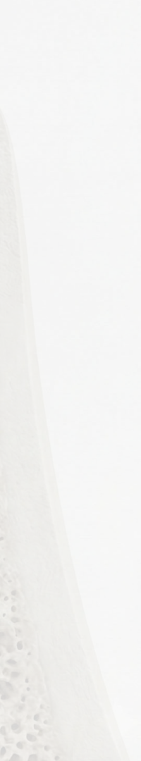 Invisalign Retainer Duration: A Detailed Look image 37